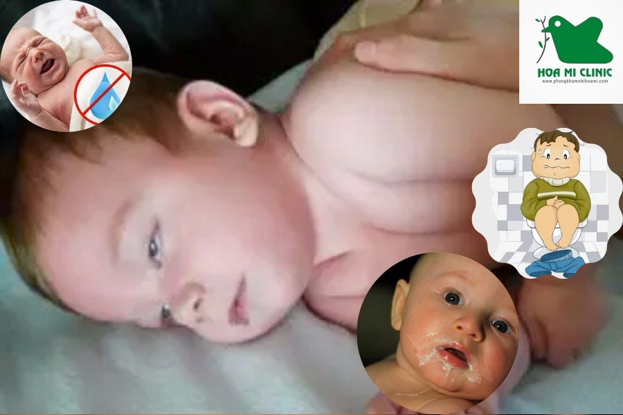 Bé bị nôn liên tục gây kiệt sức do mất nước