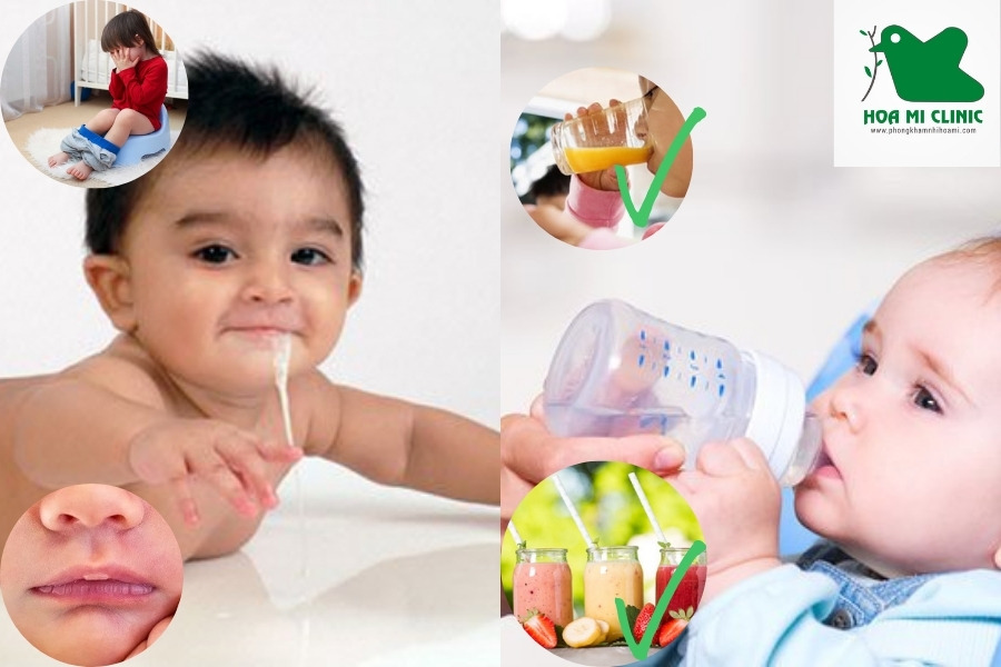 Cần bù đủ nước khi trẻ bị nôn