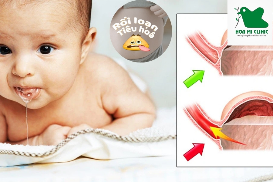 Trẻ ăn vào bị nôn ra do rối loạn hệ tiêu hóa