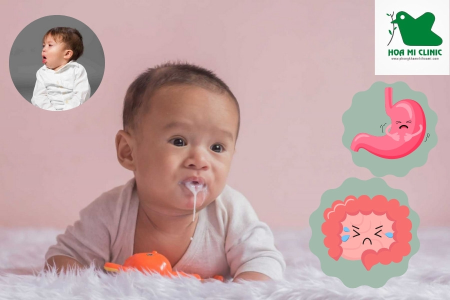 Viêm dạ dày, ruột làm trẻ bị nôn