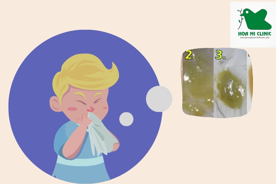 Có nhiều cách giảm ho đờm cho bé tại nhà