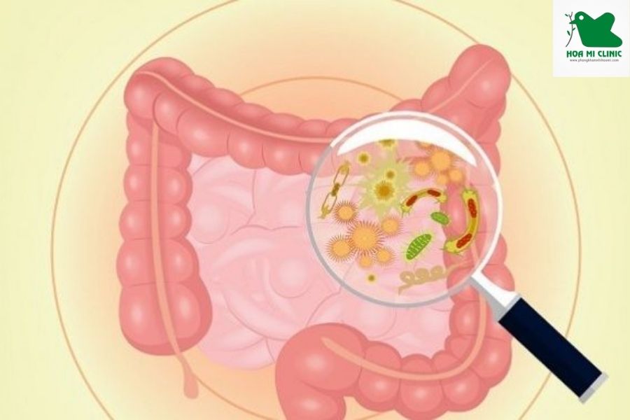 Trẻ bị viêm ruột