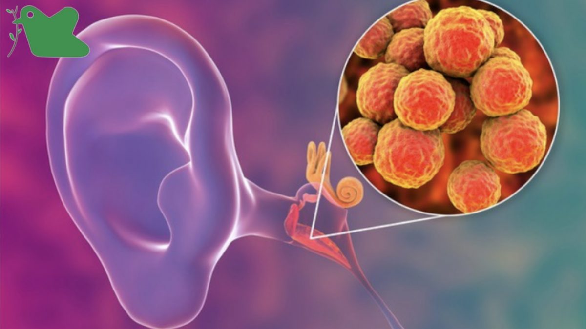 Bệnh viêm tai giữa trẻ em