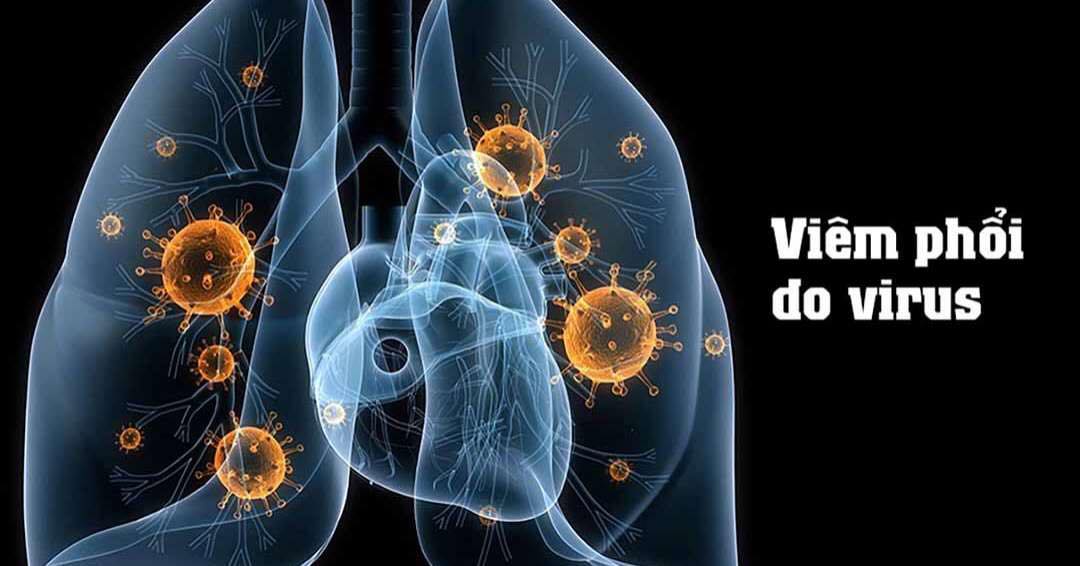 Virus RSV- nguyên nhân hàng đầu dẫn tới bệnh viêm phổi cho trẻ sơ sinh và trẻ nhỏ