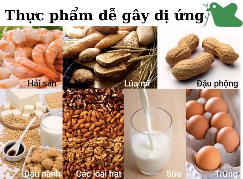 Thực phẩm dễ gây dị ứng cho trẻ