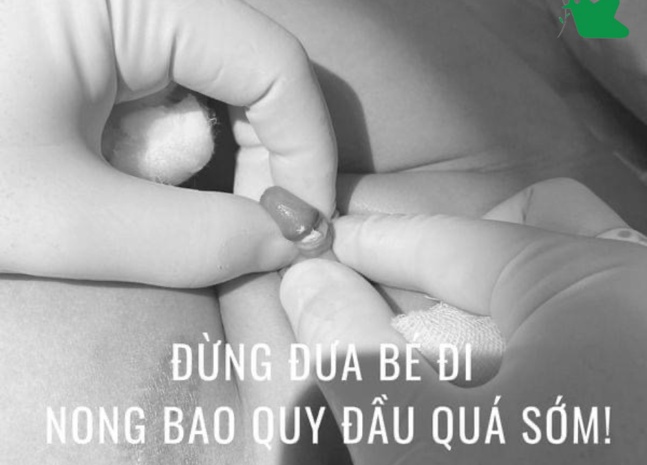 Điều trị hẹp bao quy đầu cho trẻ.