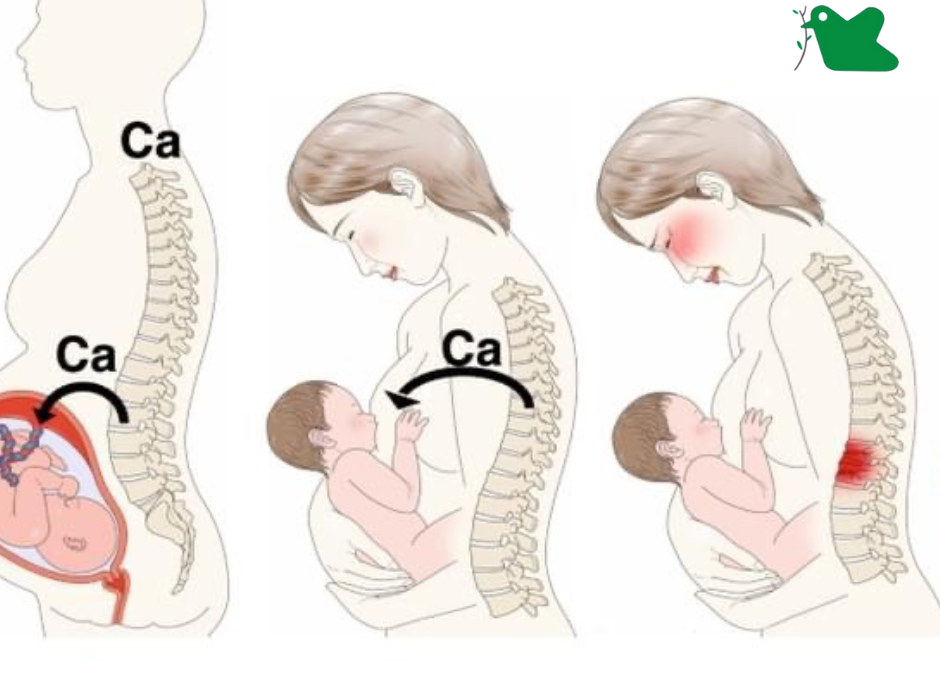 Vấn đề loãng xương ở phụ nữ sau sinh.