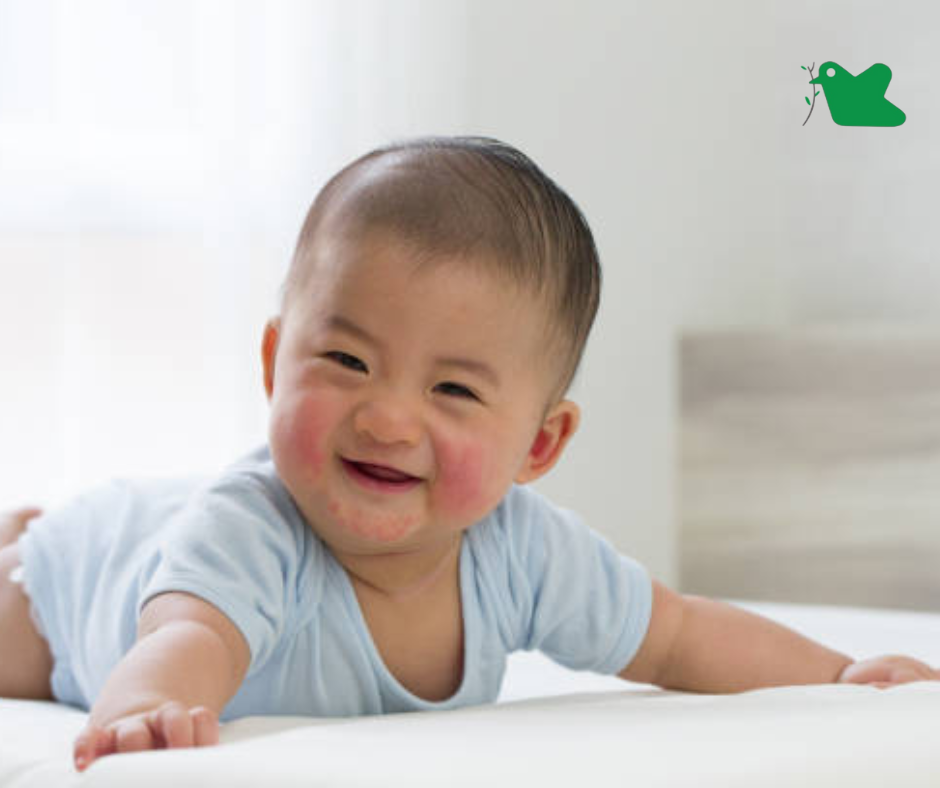 Dấu hiệu dị ứng đạm sữa bò.