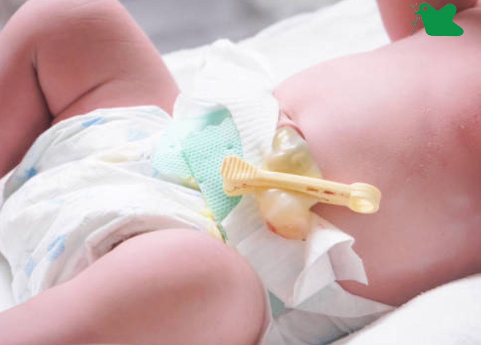 Chăm sóc rốn cho trẻ sơ sinh.