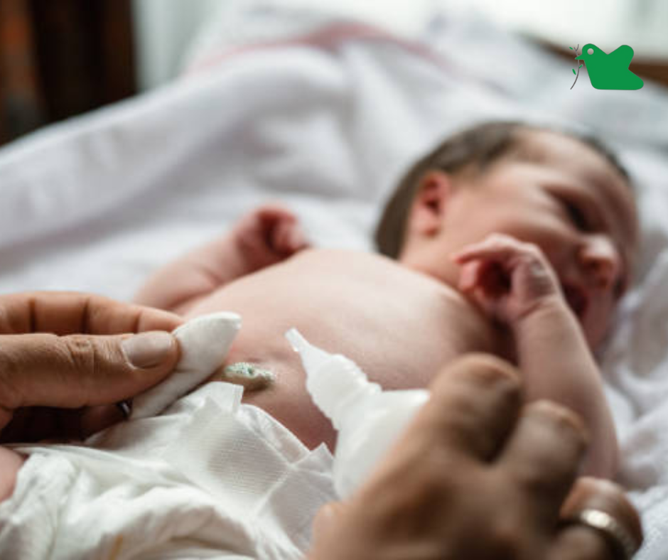 Chăm sóc rốn cho trẻ sơ sinh.