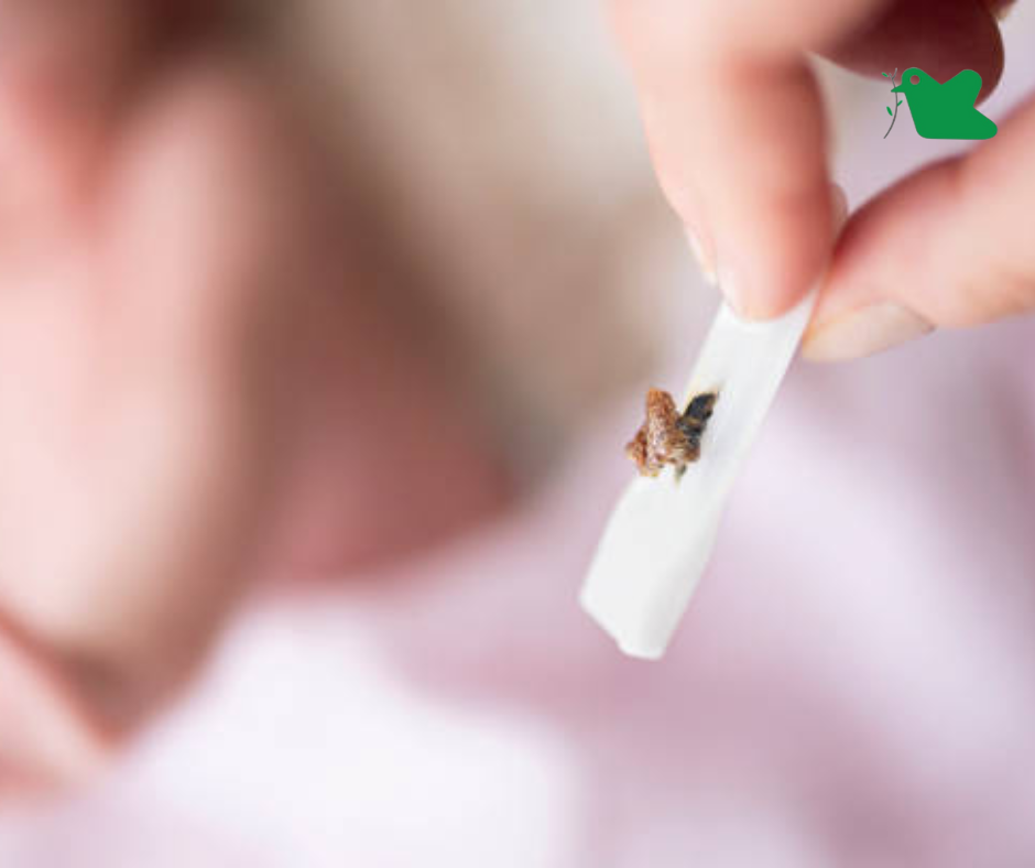 Chăm sóc rốn cho trẻ sơn sinh.